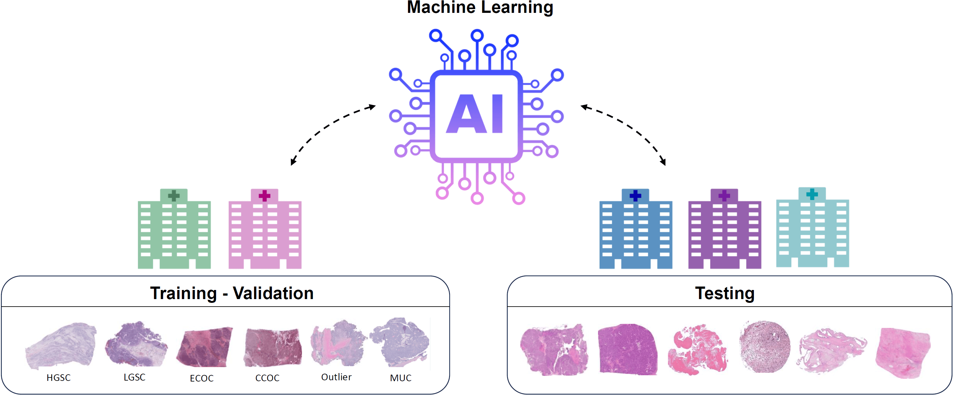 Cover Image for Ovarian Cancer Classification: Lessons Learned in a Kaggle Competition